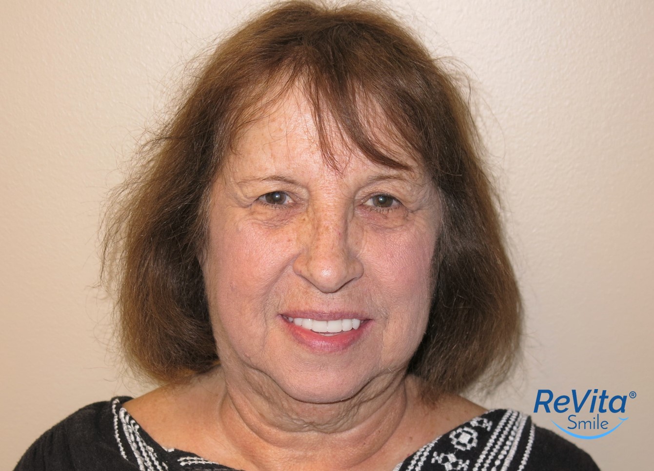 Carol after