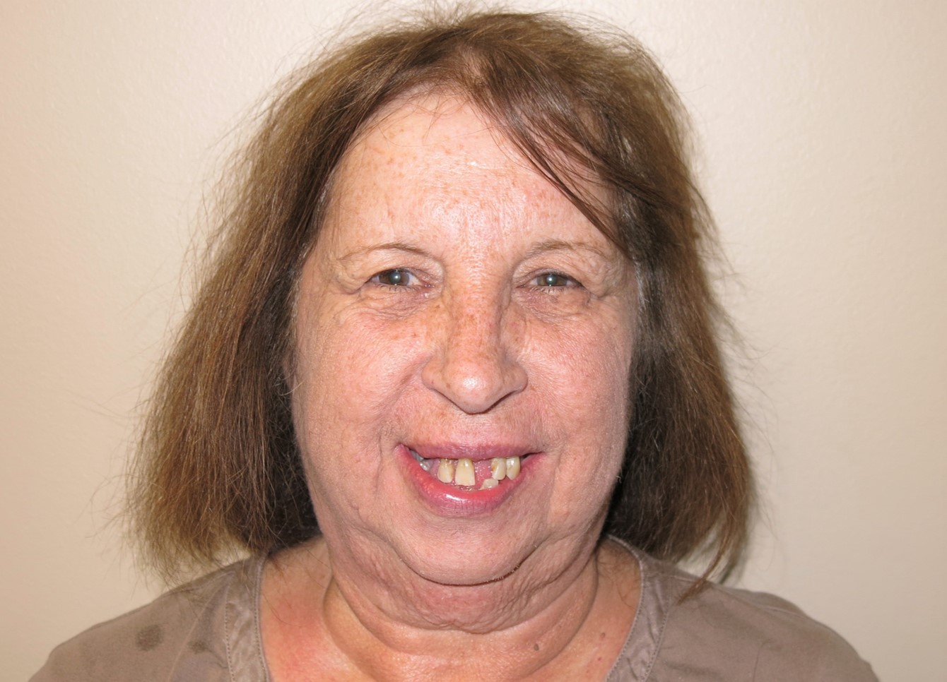 Carol before