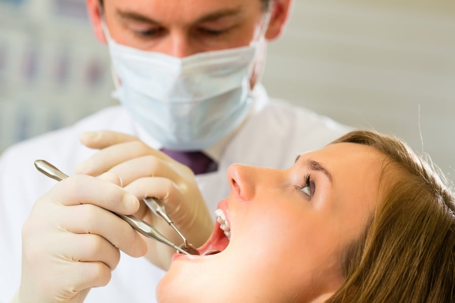 What Are Wisdom Teeth?