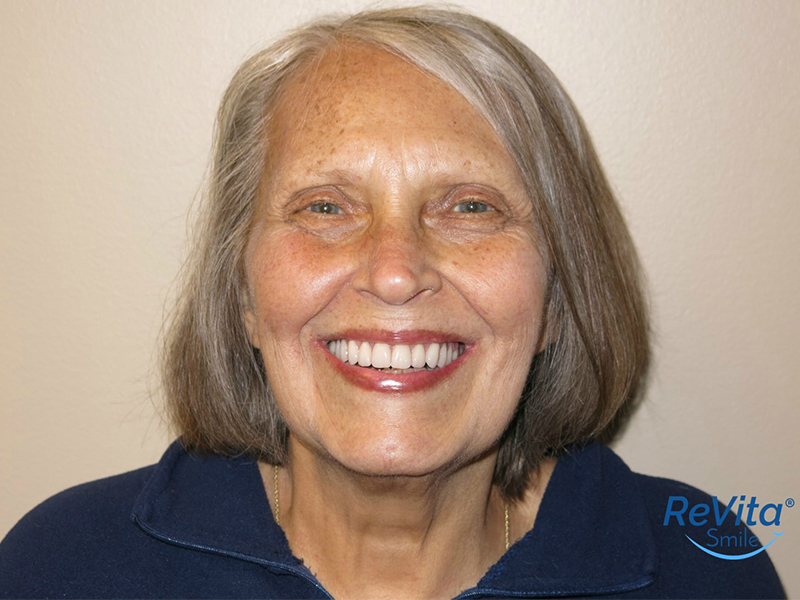 sharon2-5bd070a70ffcb