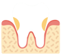 Periodontics