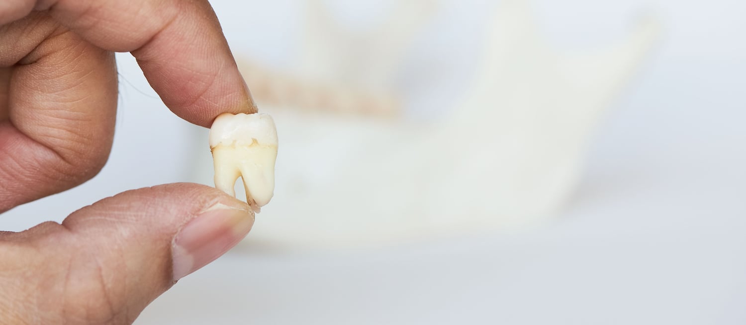 RemoveTeeth